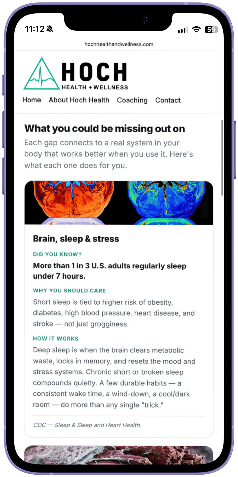 Sample Wellness Gap report — what each gap means for your body